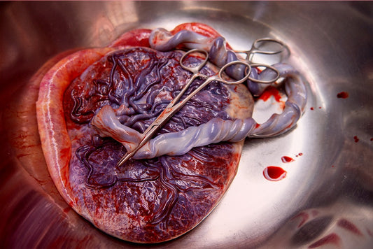 placenta-photo